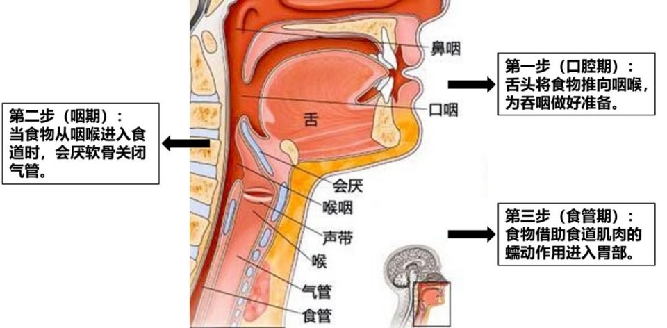 吞咽-吞咽障礙-吃飯-進(jìn)食困難-嗆咳-咳嗽-咳痰-吸入性肺炎-呼吸肌-呼吸機(jī)-冷刺激治療-腹式呼吸-縮唇呼吸-呼吸訓(xùn)練器-唾液吞咽-進(jìn)食體位管理-肺功能-肺功能檢測儀-肺炎-通氣